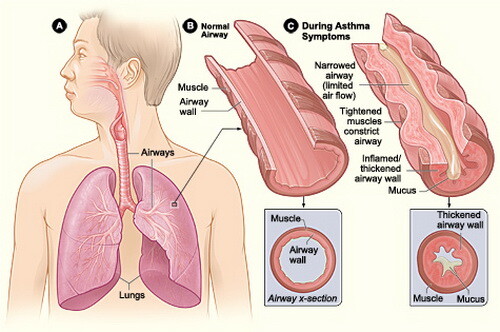 Astmatyk w górach